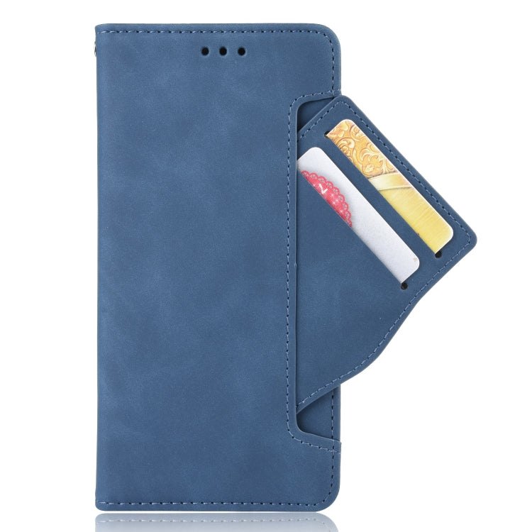 For Doogee S86 / S86 Pro Skin Feel Calf Pattern Horizontal Flip Leather Case with Holder & Card Slots & Photo Frame(Blue) - More Brand by buy2fix | Online Shopping UK | buy2fix